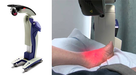 mls laser therapy