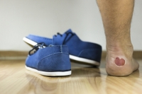 What Can Cause Foot Blisters?
