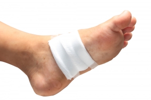How Wounds Affect the Layers of the Skin